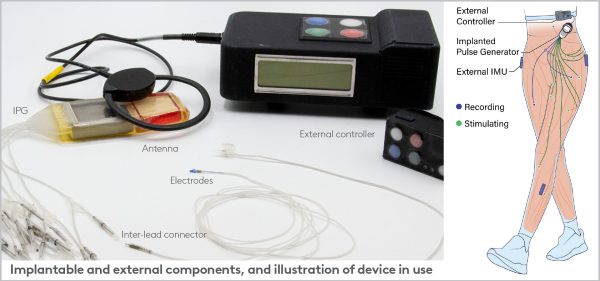 Pressing All The Right Buttons for Stroke Rehabilitation